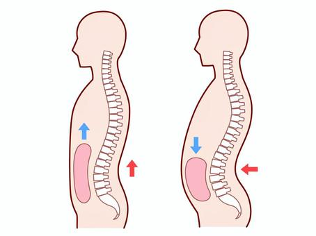反り腰のイメージ画像