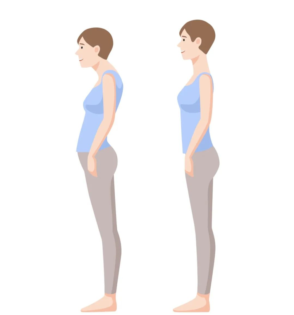 スウェイバッグ姿勢のイメージ画像